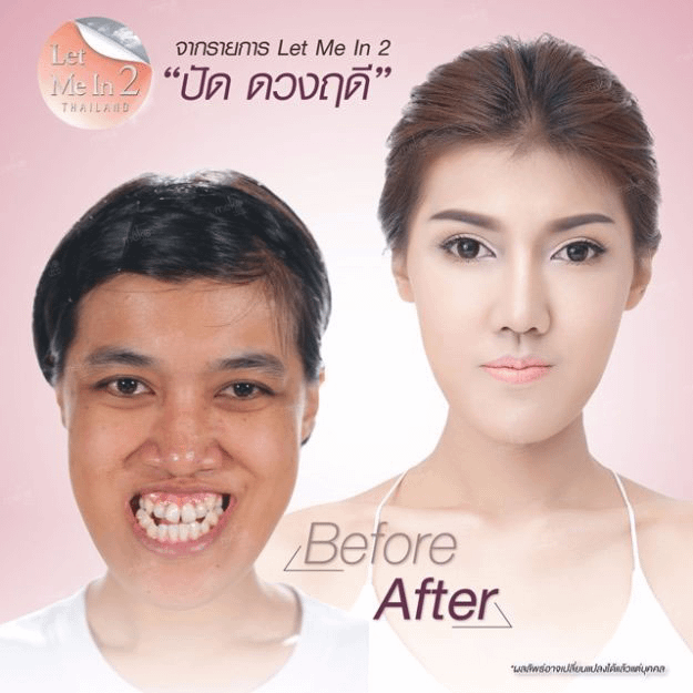 Canoni estetici thailandesi