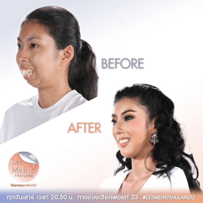 Canoni estetici thailandesi
