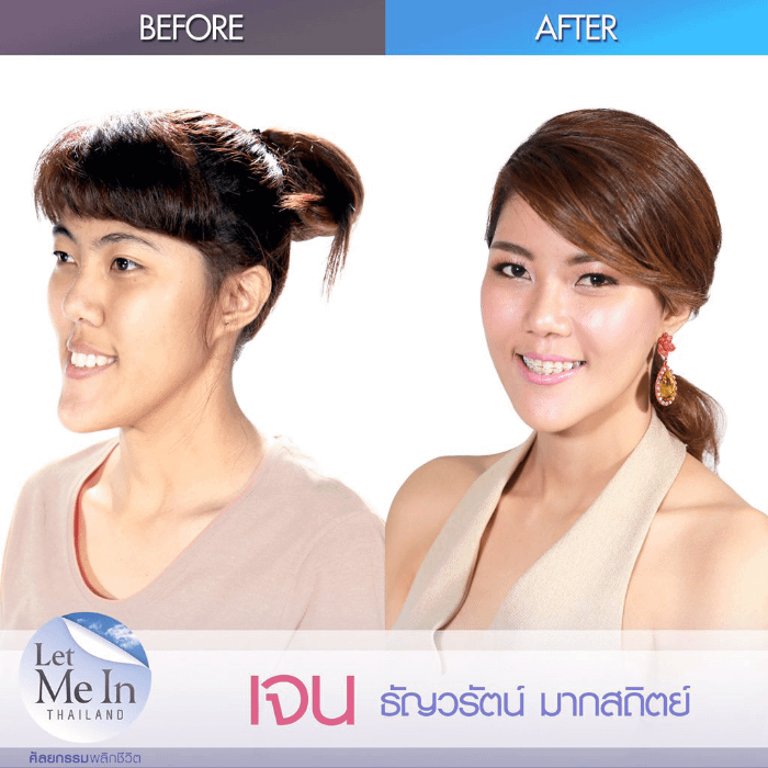 Canoni estetici thailandesi