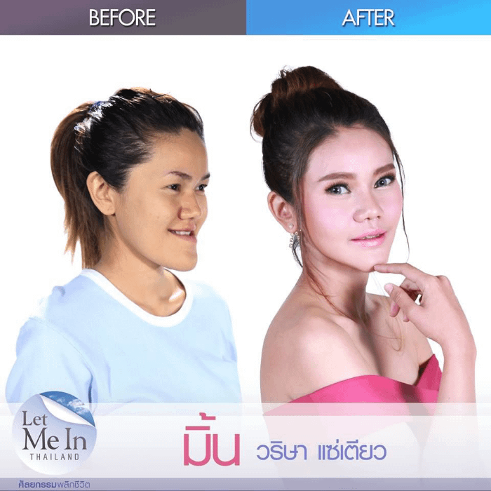 Canoni estetici thailandesi